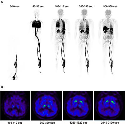 Pilot study on 11C-CFT dynamic imaging using total-body PET/CT: biodistribution and radiation dosimetry in Parkinson's disease